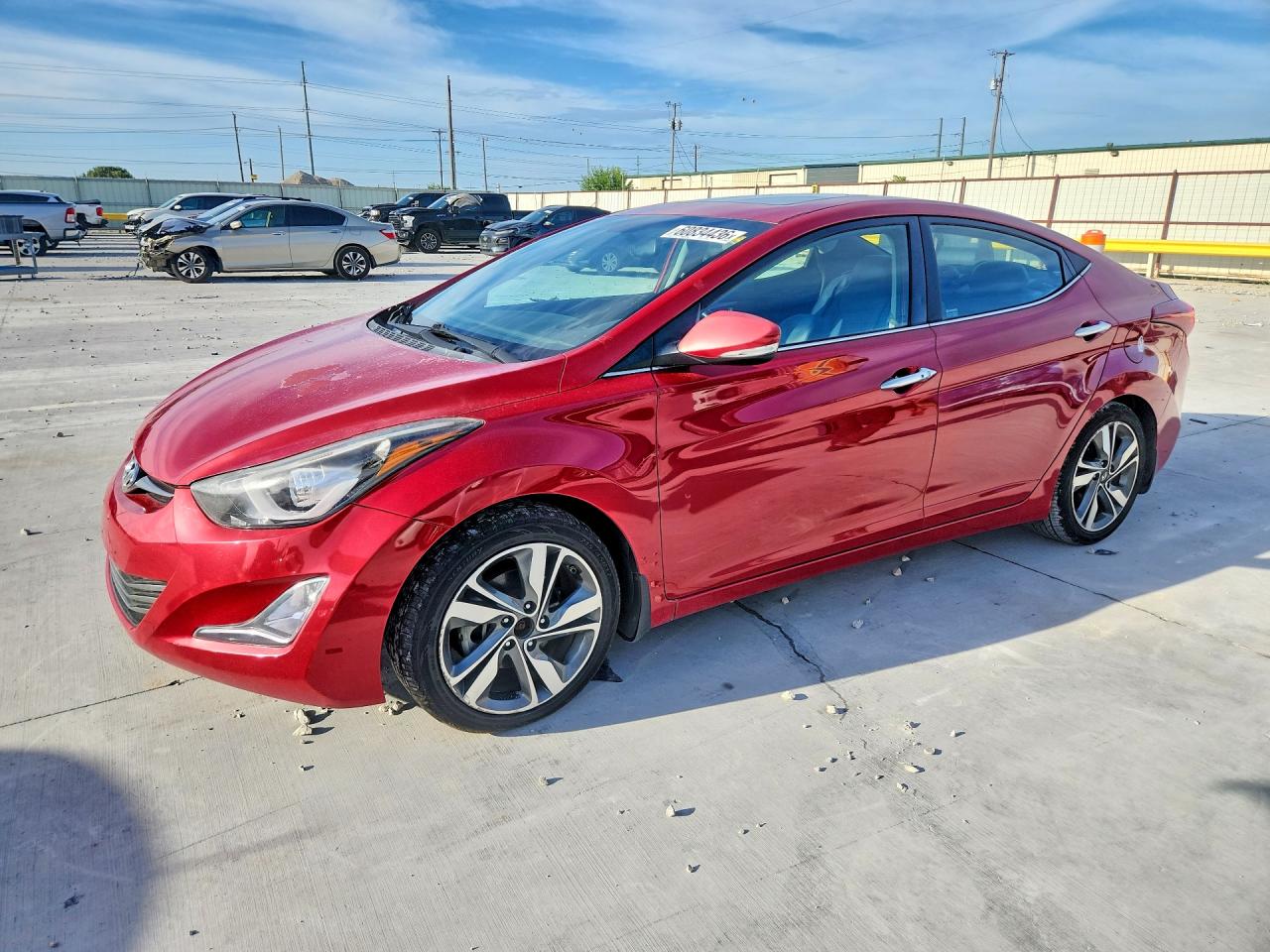 2016 Hyundai Elantra — Front End — aukcja Copart tx - ft. worth - 1